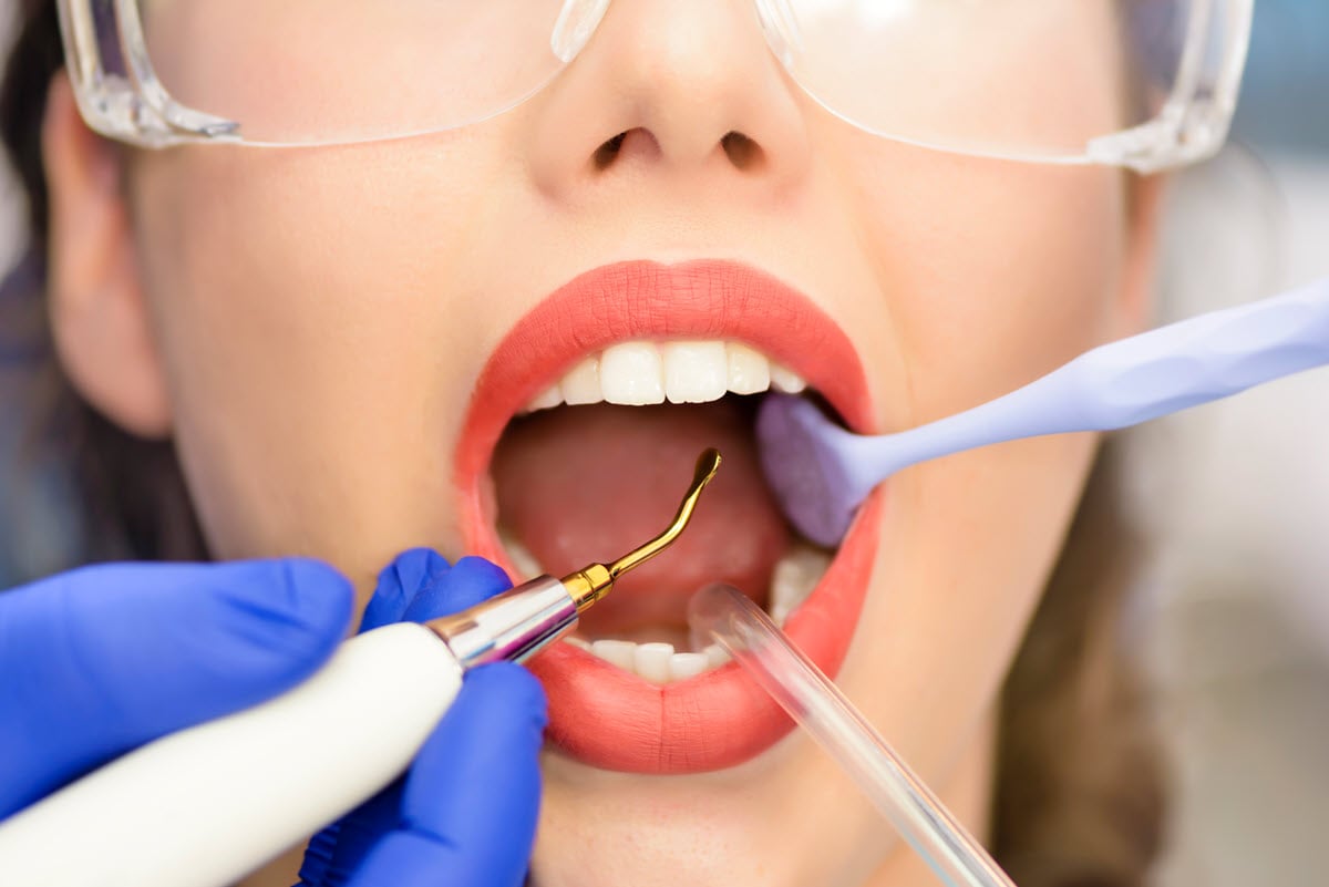 King Dentistry Root Canal